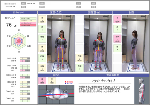 からだバランス画像解析1